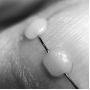 Podologický titánový drôt Ø 0,3 mm